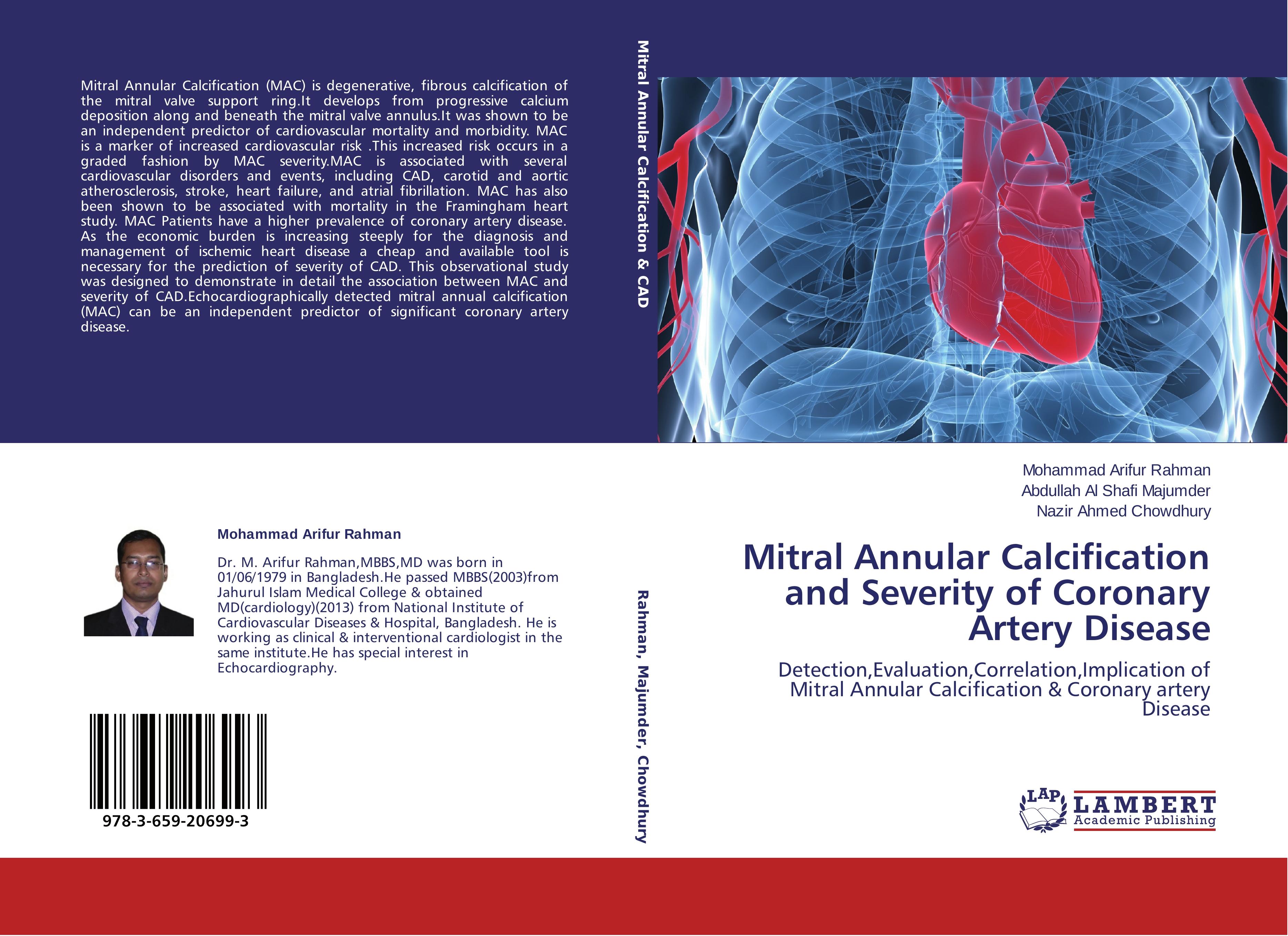 Produktbild: Mitral Annular Calcification and Severity of Coronary Artery Disease
