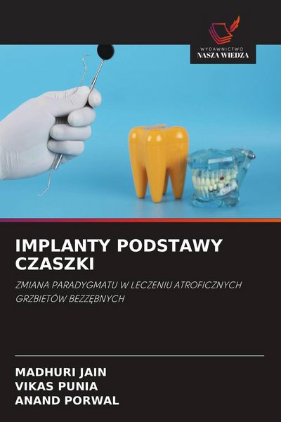 Produktbild: IMPLANTY PODSTAWY CZASZKI