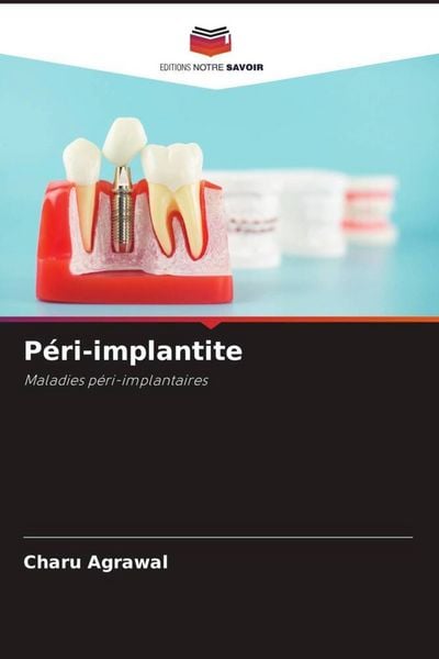 Produktbild: P&eacute;ri-implantite