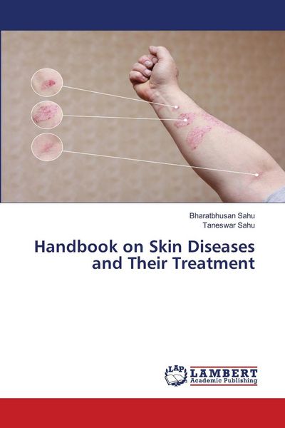 Produktbild: Handbook on Skin Diseases and Their Treatment