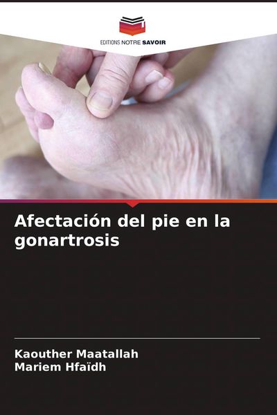 Produktbild: Afectaci&oacute;n del pie en la gonartrosis