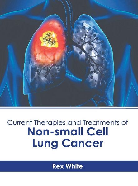 Produktbild: Current Therapies and Treatments of Non-Small Cell Lung Cancer