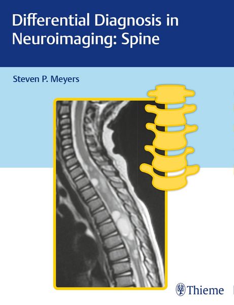 Produktbild: Differential Diagnosis in Neuroimaging: Spine