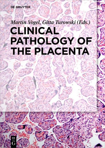 Produktbild: Clinical Pathology of the Placenta