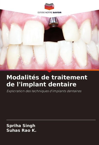 Produktbild: Modalit&eacute;s de traitement de l'implant dentaire