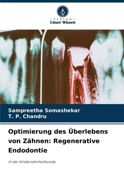 Optimierung des Überlebens von Zähnen: Regenerative Endodontie, Taschenbuch von Sampreetha Somashekar , T. P. Chandru, Verlag Unser Wissen,