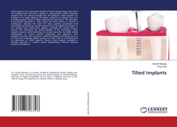 Produktbild: Tilted Implants
