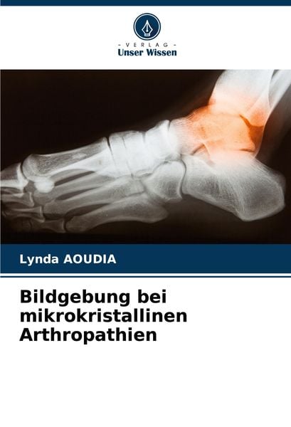 Produktbild: Bildgebung bei mikrokristallinen Arthropathien