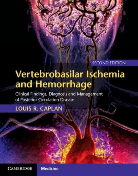 Produktbild: Vertebrobasilar Ischemia and Hemorrhage