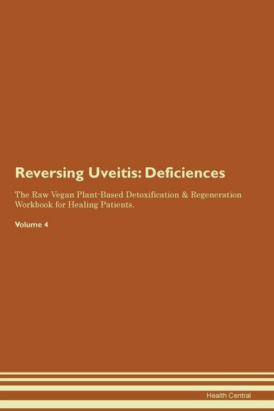 Produktbild: Reversing Uveitis
