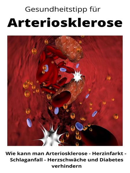 Produktbild: Gesundheitstipp f&uuml;r Arteriosklerose