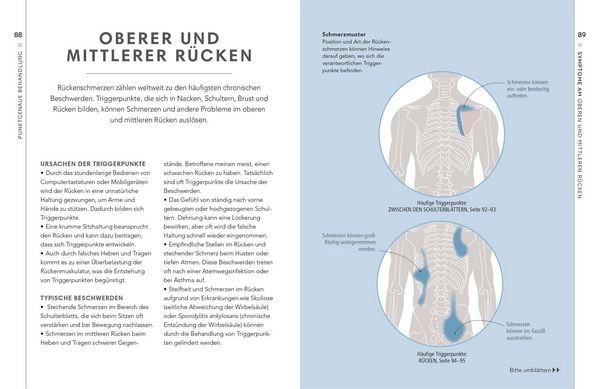 Produktbild: Triggerpunkte