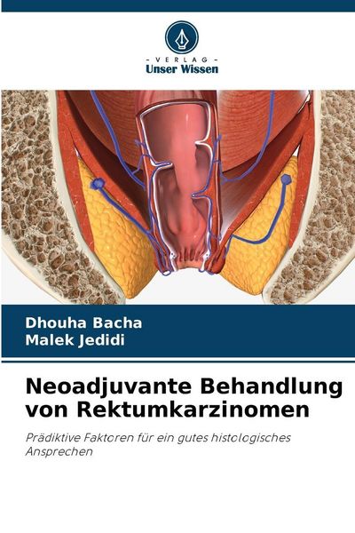Neoadjuvante Behandlung von Rektumkarzinomen, Taschenbuch von Dhouha Bacha , Malek Jedidi, Verlag Unser Wissen, 9786208499136