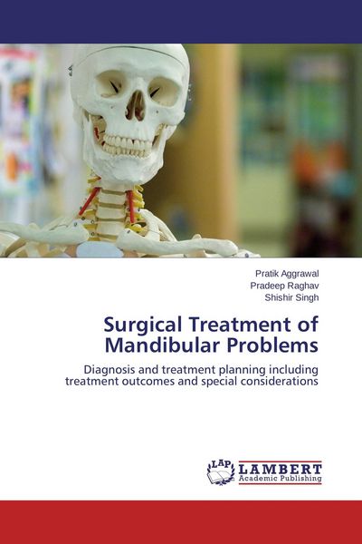 Produktbild: Surgical Treatment of Mandibular Problems