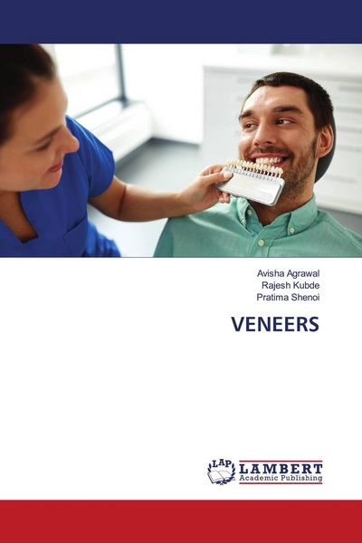 Produktbild: Veneers