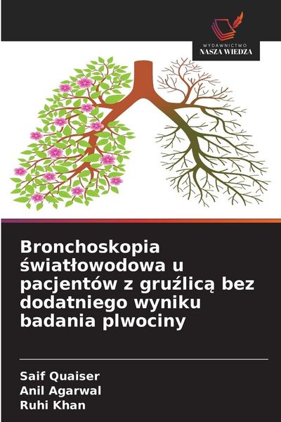 Produktbild: Bronchoskopia swiatlowodowa u pacjent&oacute;w z gruzlica bez dodatniego wyniku badania plwociny