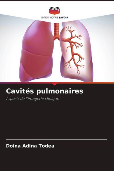 Produktbild: Cavit&eacute;s pulmonaires