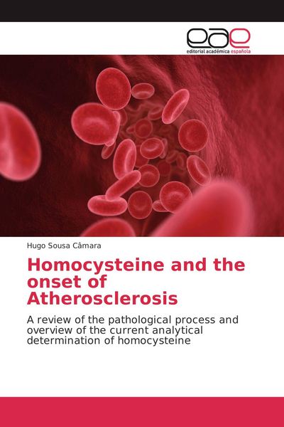 Produktbild: Homocysteine and the onset of Atherosclerosis