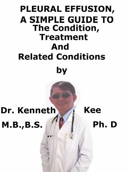 Produktbild: Pleural Effusion, A Simple Guide To The Condition, Treatment And Related Conditions