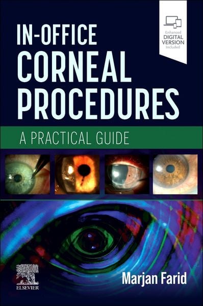 Produktbild: In-Office Corneal Procedures