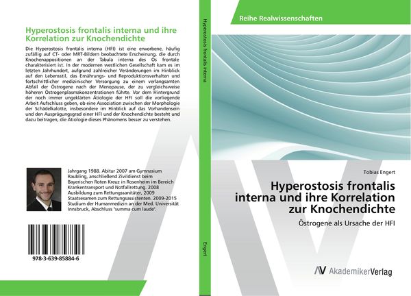 Hyperostosis frontalis interna und ihre Korrelation zur Knochendichte, Taschenbuch von Tobias Engert, AV Akademikerverlag, 9783639858846