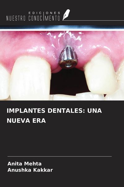 Produktbild: Implantes Dentales: Una Nueva Era