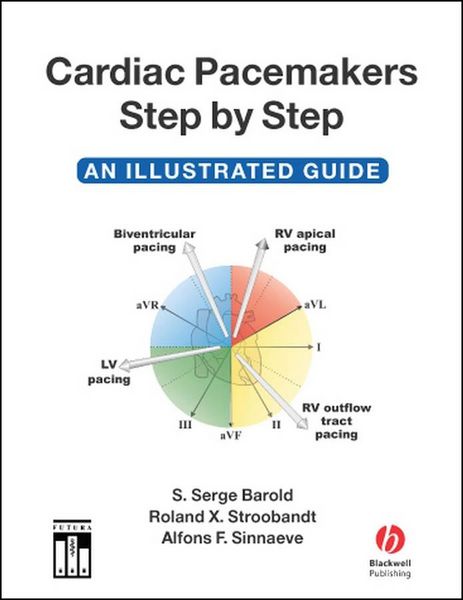 Produktbild: Cardiac Pacemakers Step by Step