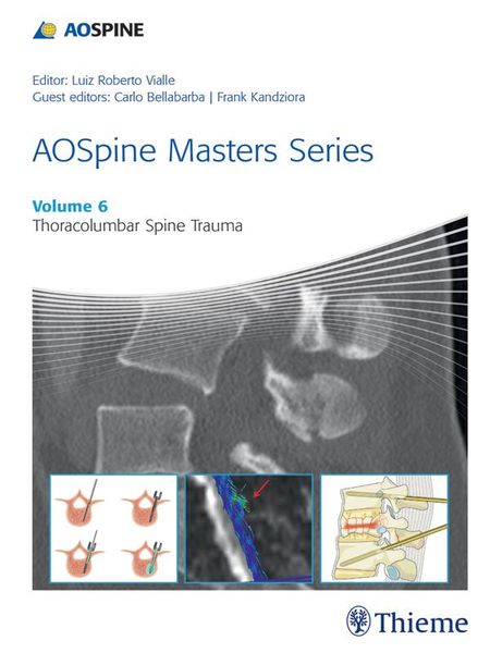 Produktbild: AOSpine Masters Series, Volume 6: Thoracolumbar Spine Trauma
