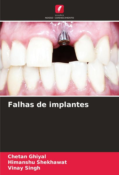 Produktbild: Falhas de implantes