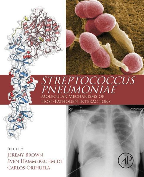 Produktbild: Streptococcus Pneumoniae