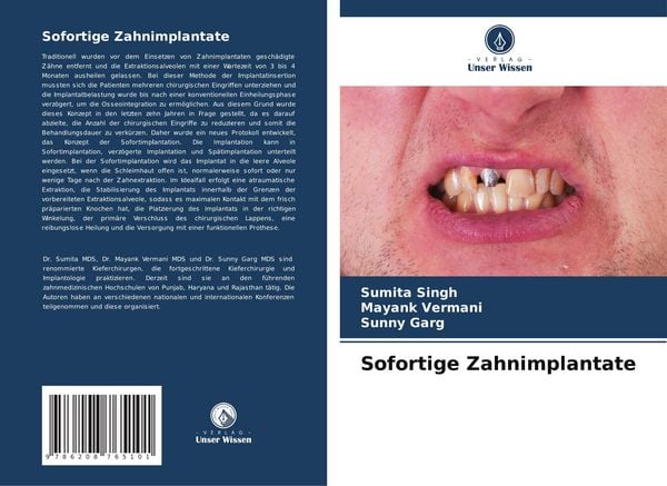 Produktbild: Sofortige Zahnimplantate