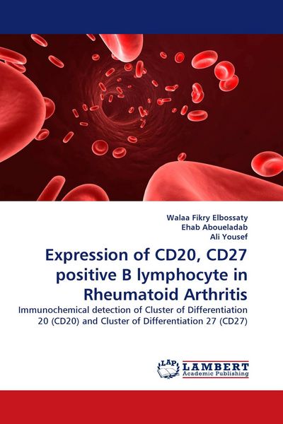 Produktbild: Expression of CD20, CD27 positive B lymphocyte in Rheumatoid Arthritis