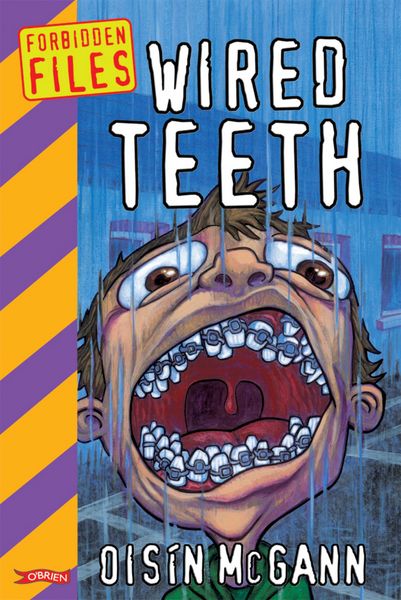 Produktbild: Wired Teeth