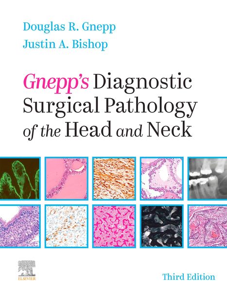 Produktbild: Gnepp's Diagnostic Surgical Pathology of the Head and Neck E-Book