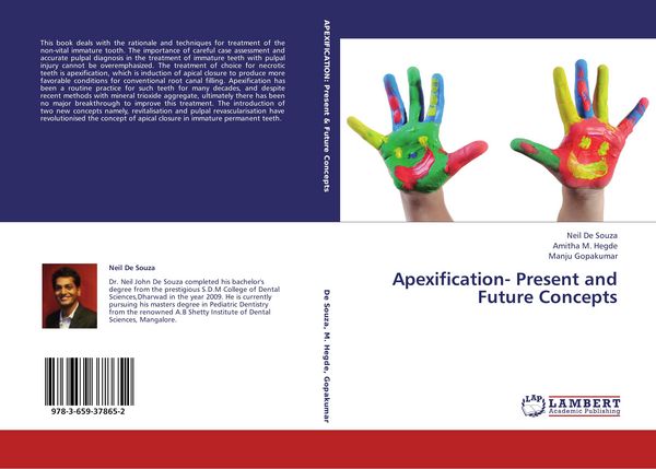 Produktbild: Apexification- Present and Future Concepts