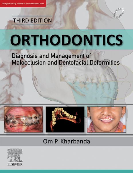 Produktbild: Orthodontics: Diagnosis and Management of Malocclusion and Dentofacial Deformities, E-Book