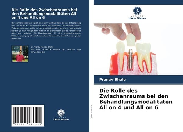 Produktbild: Die Rolle des Zwischenraums bei den Behandlungsmodalit&auml;ten All on 4 und All on 6