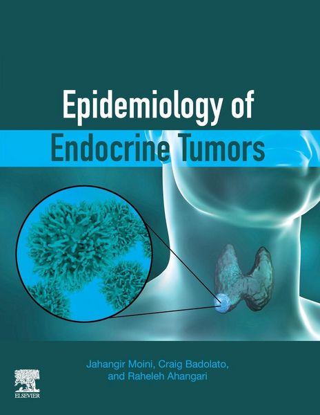 Produktbild: Epidemiology of Endocrine Tumors