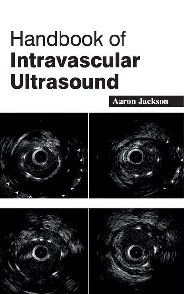 Produktbild: Handbook of Intravascular Ultrasound