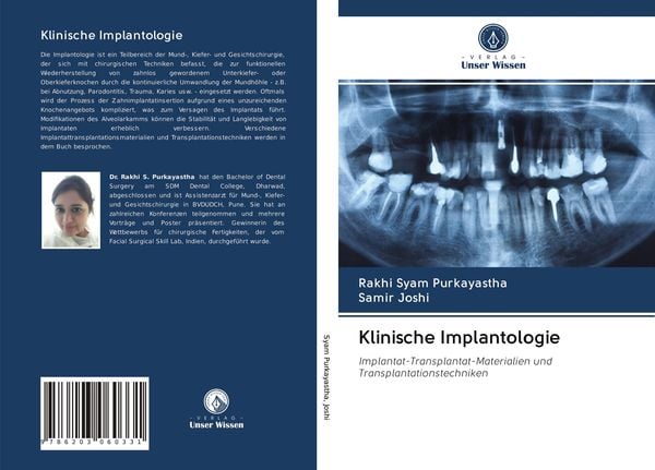 Klinische Implantologie, Taschenbuch von Rakhi Syam Purkayastha , Samir Joshi, Verlag Unser Wissen, 9786203060331