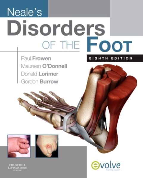 Produktbild: Frowen, P: Neale's Disorders of the Foot