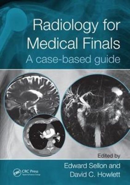Produktbild: Radiology for Medical Finals