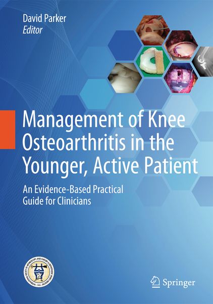 Produktbild: Management of Knee Osteoarthritis in the Younger, Active Patient