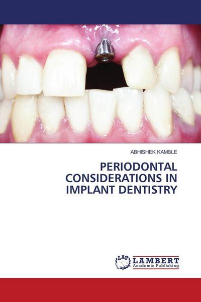 Produktbild: PERIODONTAL CONSIDERATIONS IN IMPLANT DENTISTRY