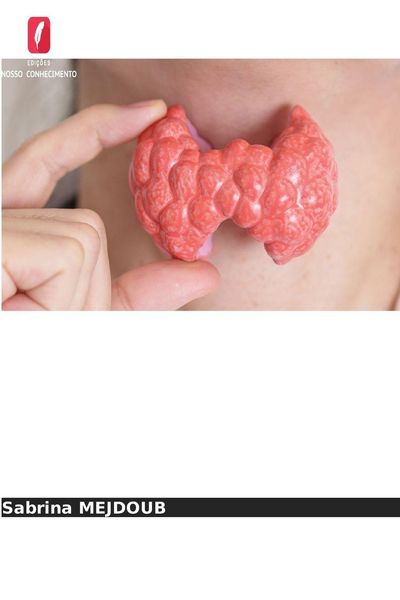 Produktbild: Determina&ccedil;&atilde;o da tiroglobulina e dos anticorpos anti-tiroglobulina