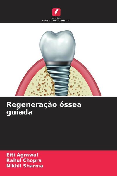 Produktbild: Regenera&ccedil;&atilde;o &oacute;ssea guiada