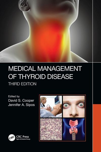 Produktbild: Medical Management of Thyroid Disease, Third Edition