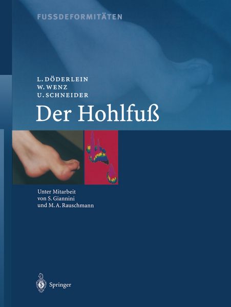 Fussdeformitäten, Taschenbuch von L. Döderlein , W. Wenz , U. Schneider, Springer Berlin, 9783642630996