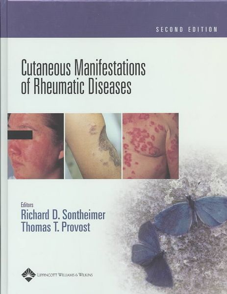 Produktbild: Cutaneous Manifestations of Rheumatic Diseases