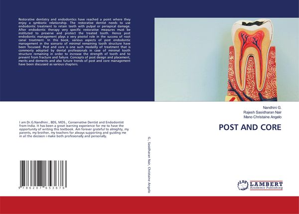 Produktbild: Post and Core